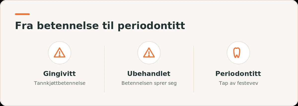 Illustrasjon som viser utviklingen fra tannkjøttbetennelse til periodontitt med tap av festevev.